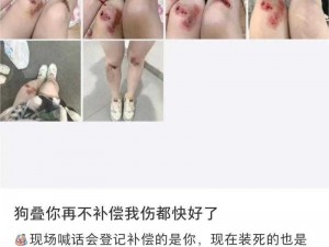 浓毛 BwBwBwBwBw 让你尴尬不已？如何解决？