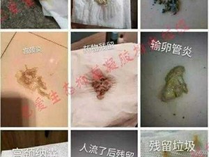 爷爷帮小蝶排阴毒，怎样排出来？为什么要排阴毒？如何排阴毒？