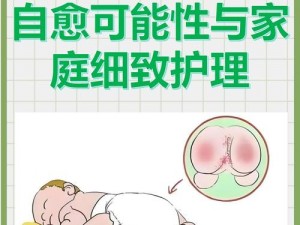 幼儿私密部位开裂红肿怎么办？视频教程来帮忙