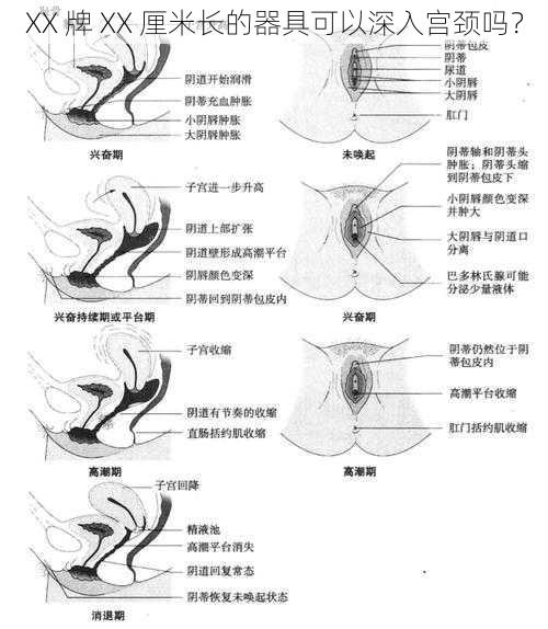 XX 牌 XX 厘米长的器具可以深入宫颈吗？