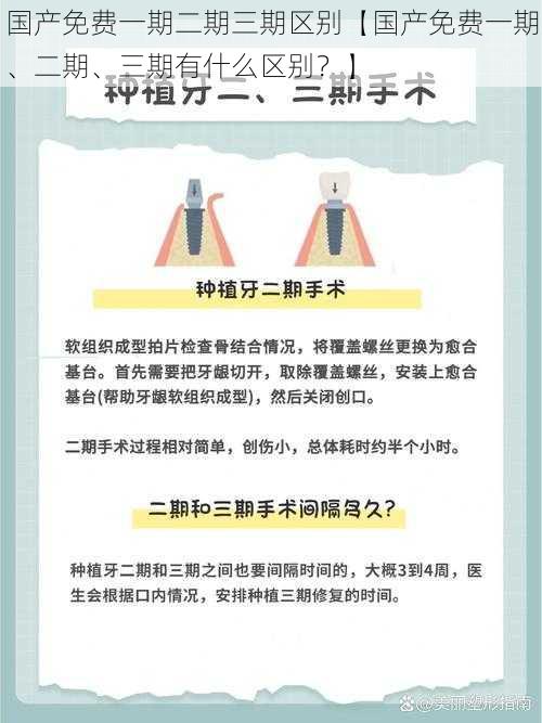 国产免费一期二期三期区别【国产免费一期、二期、三期有什么区别？】