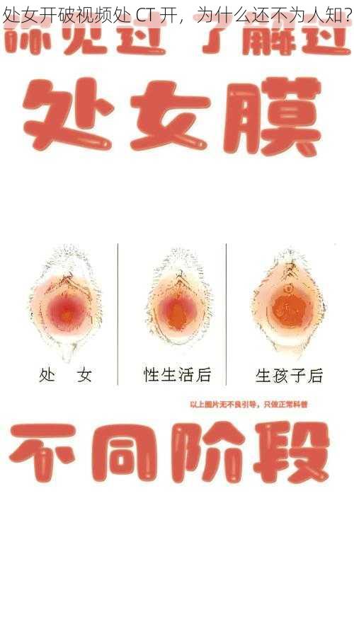 处女开破视频处 CT 开，为什么还不为人知？